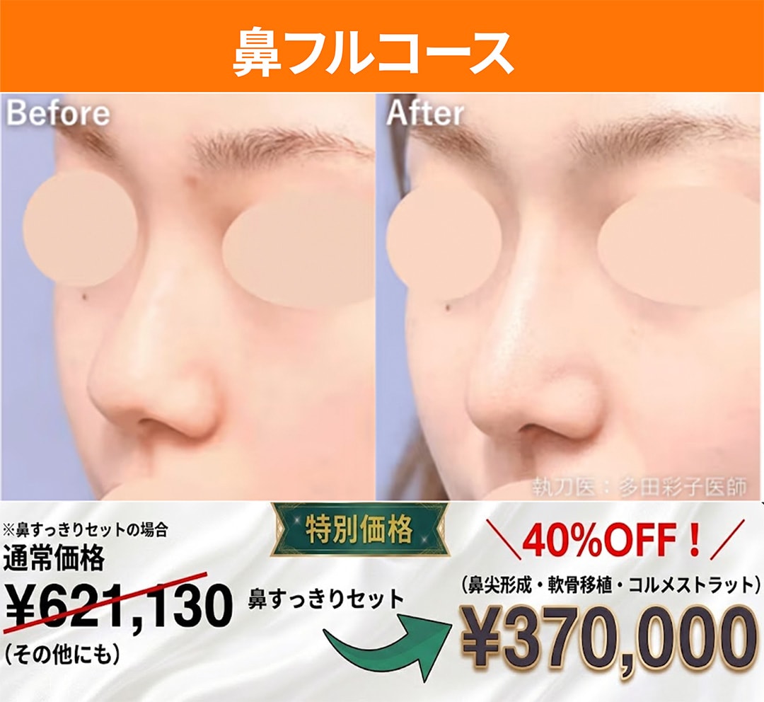 鼻フルコース