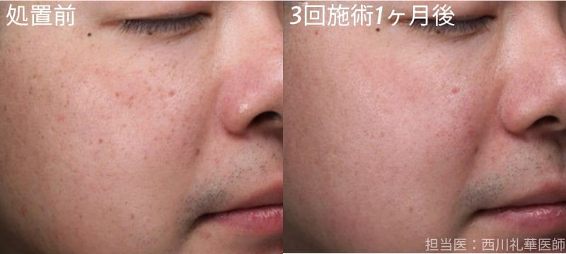 フォトダブル