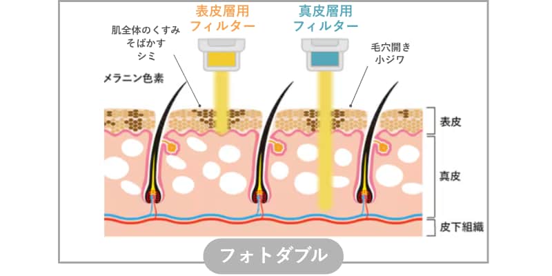フォトダブル®