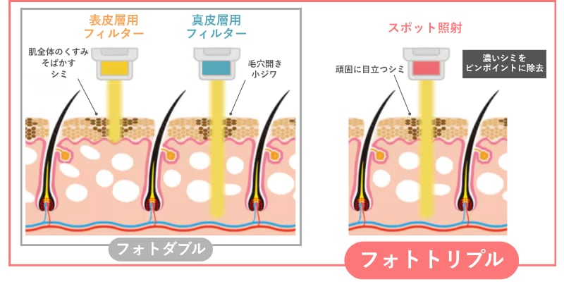 フォトトリプル
