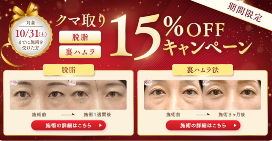 クマ取り 15%OFFキャンペーン