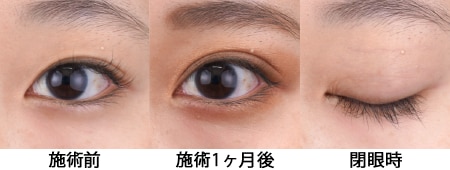 保存数No.3 中間幅平行型