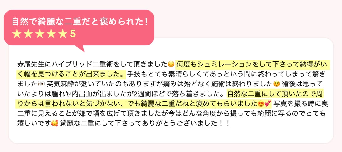 自然で綺麗な二重だと褒められた!