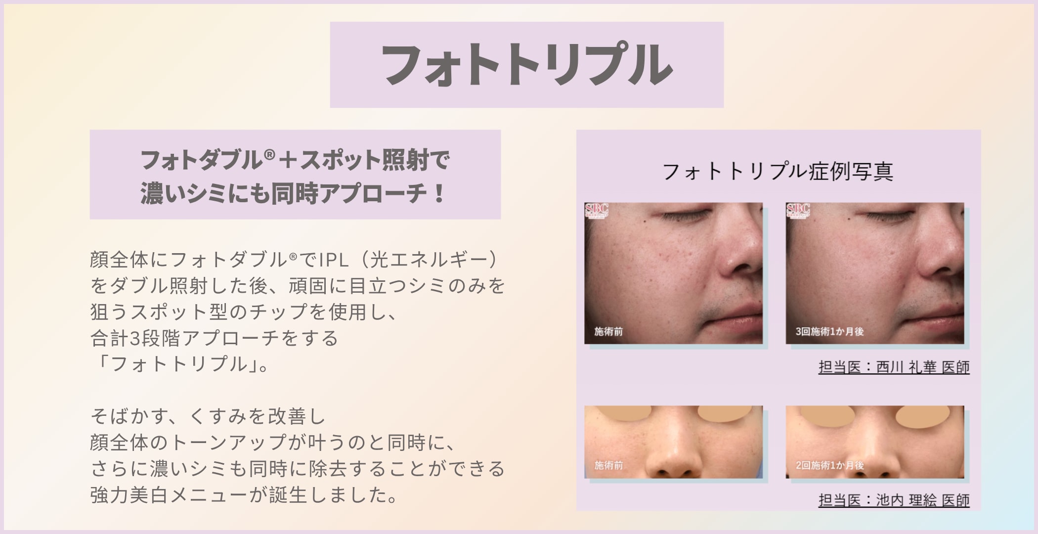 フォトトリプルとは？