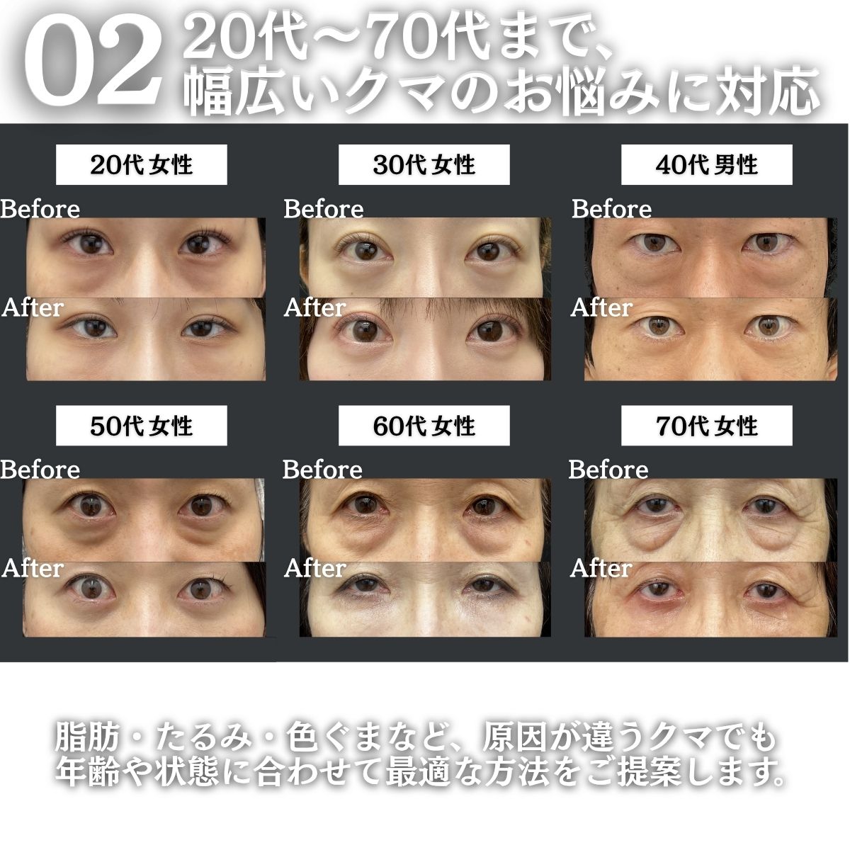 美しい仕上がりを追求したデザイン力