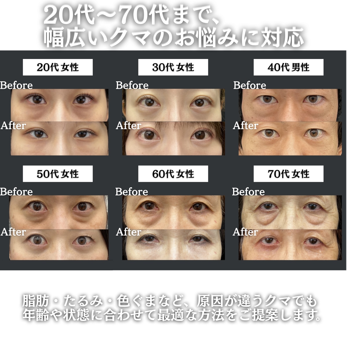 様々な年代の経過