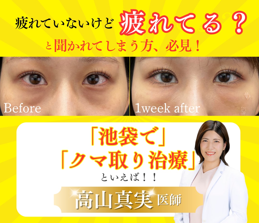 池袋で【クマ取り】なら女医の高山真実医師｜料金・裏ハムラ・ダウンタイムが気になる方必見！