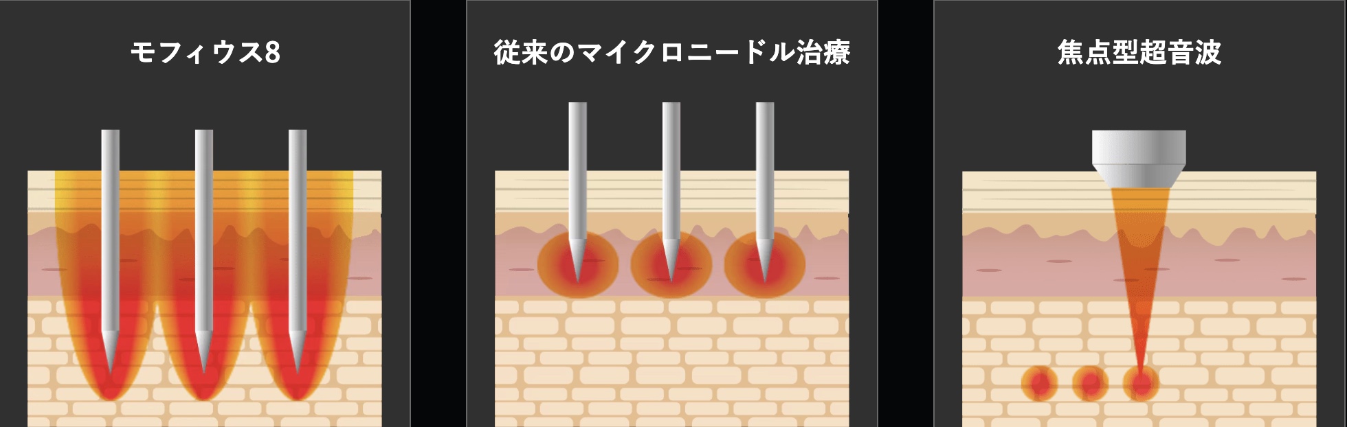 モフィウス8の仕組み