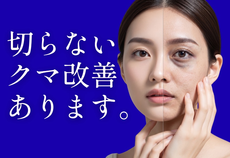 「本当に切らなくていいの?」に答えます。池袋東口院で叶える、攻めの脱・クマ治療