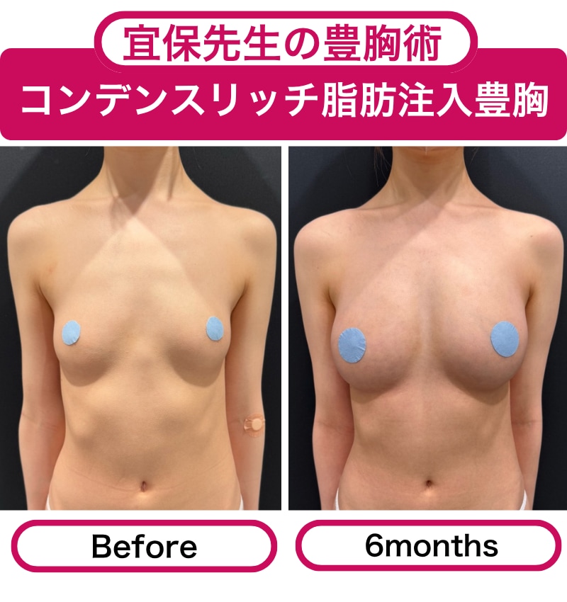 脂肪/シリコン/ハイブリッド <br />
全てお任せ下さい！