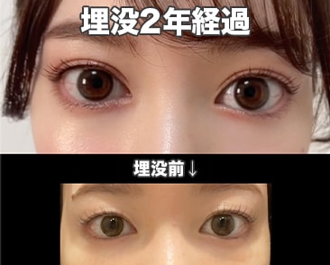 個人差が大きい