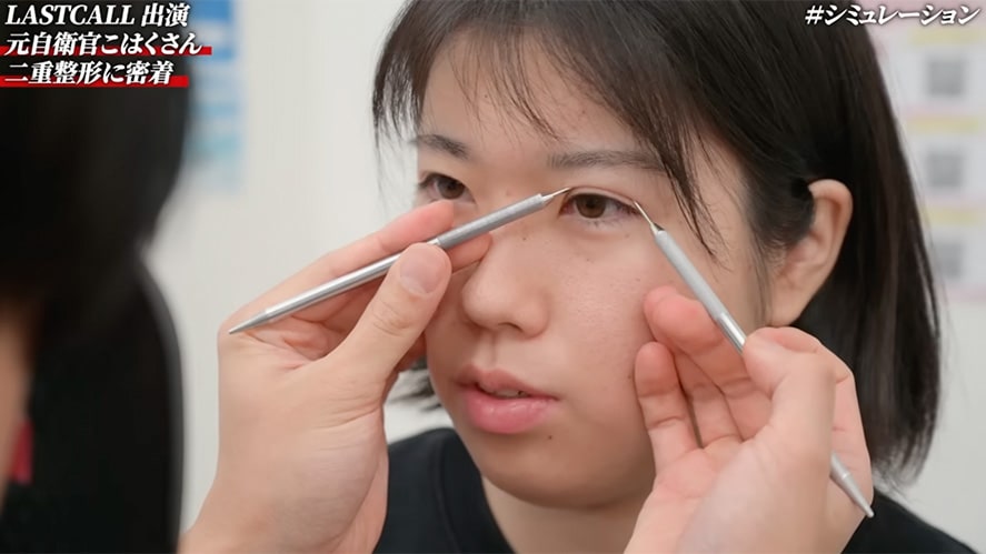 赤尾医師の提案　「劇的垢抜け×化粧映え二重」<br />
