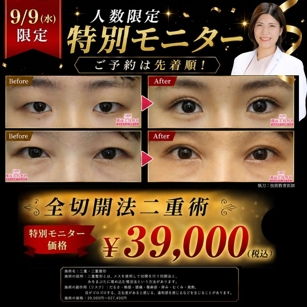 湘南美容池袋東口院_特別モニター
