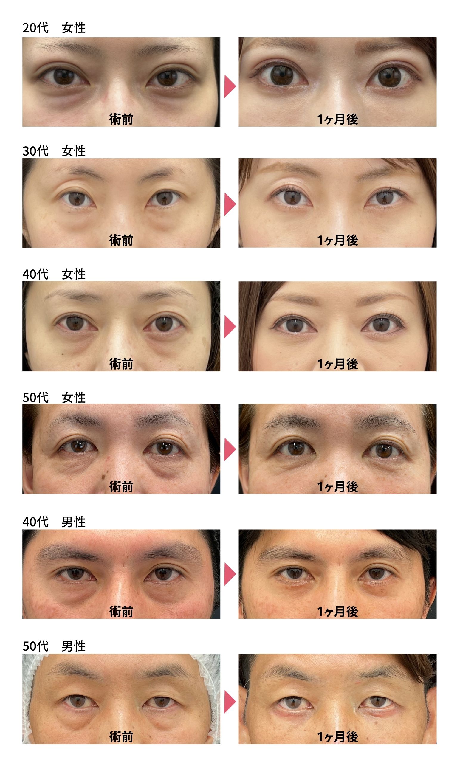 磨かれた技術力が、綺麗な仕上がりに繋がっています。