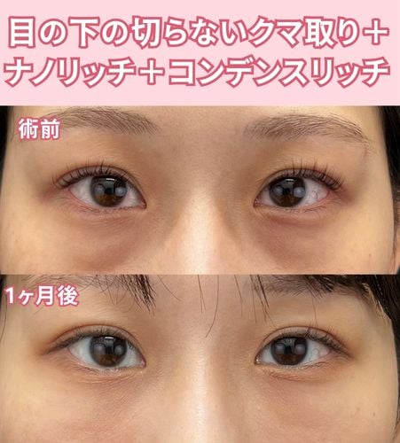 20代女性の症例解説<br />
