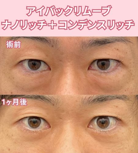 40代男性の症例解説<br />
