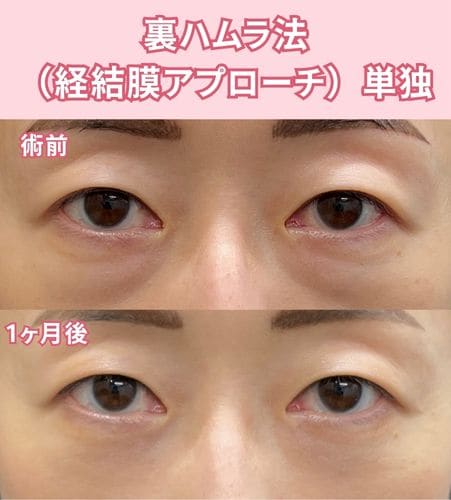 40代女性の症例解説