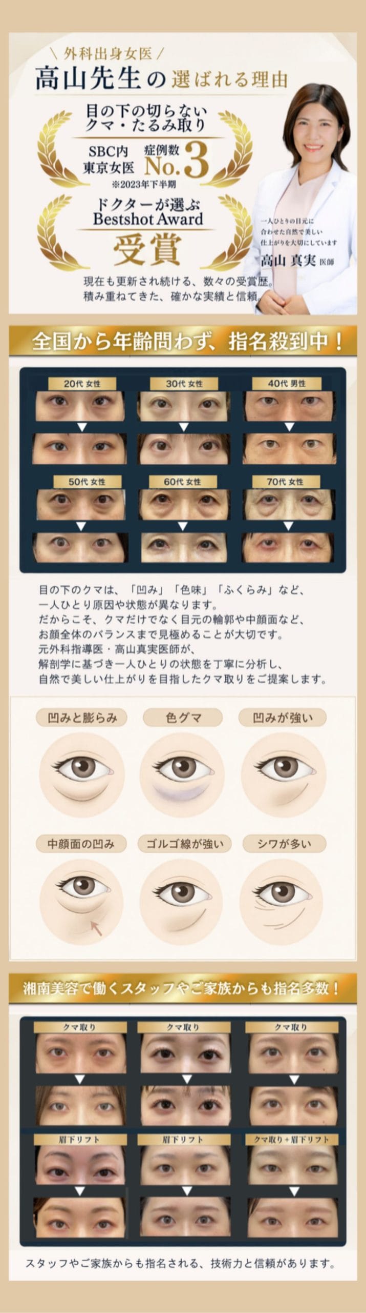 池袋でクマ取りをご検討中の方へ