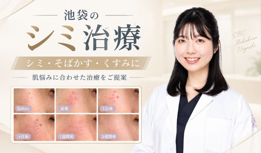 池袋のシミ取り・シミ治療｜シミ・そばかす・くすみの相談なら湘南美容クリニック池袋東口院