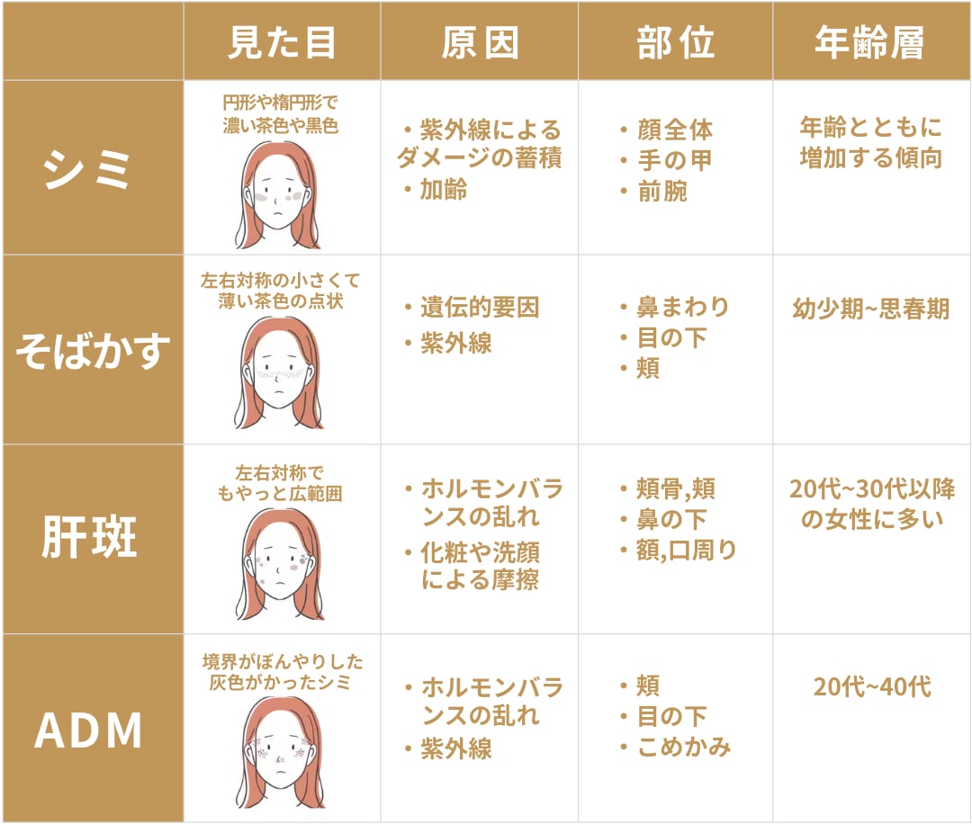 シミ治療は医師の判断が重要です