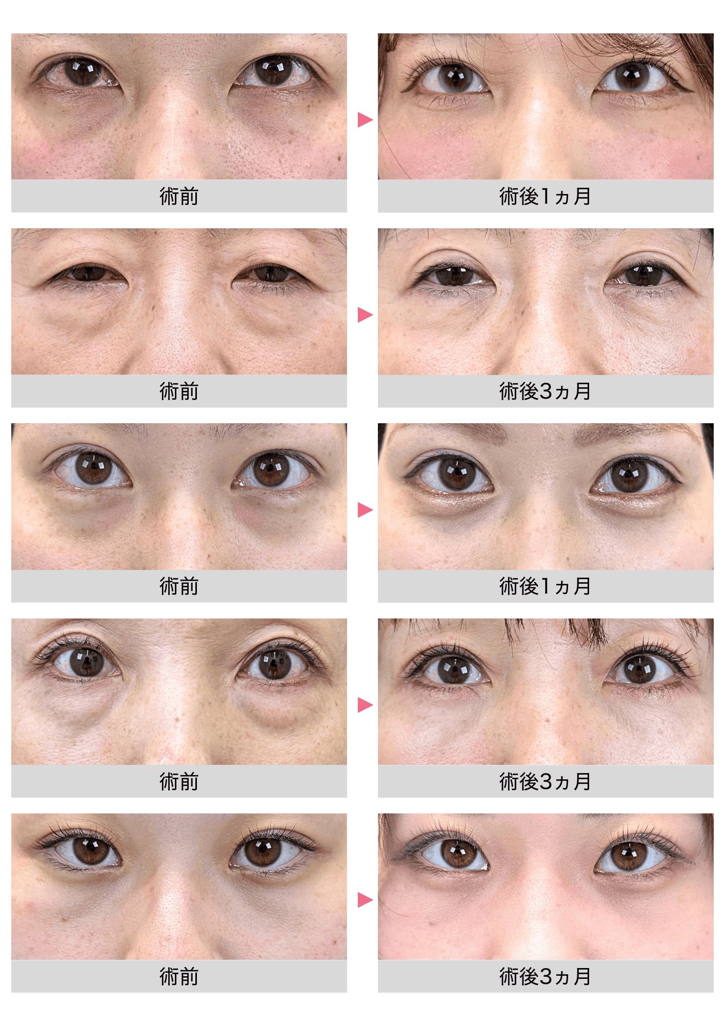 豊富な手術経験と確かな技術