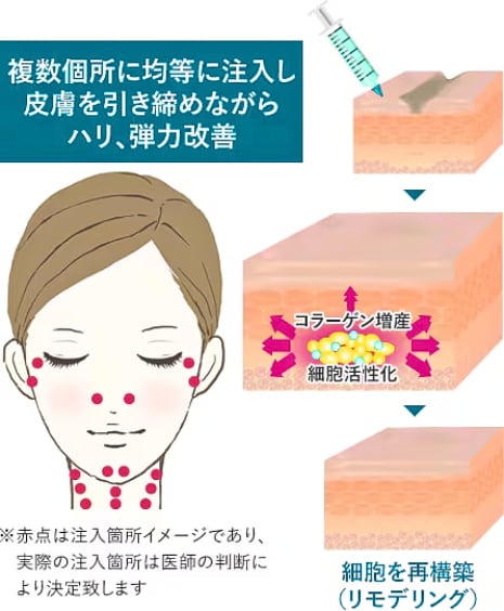今までのヒアルロン酸と何が違うの?