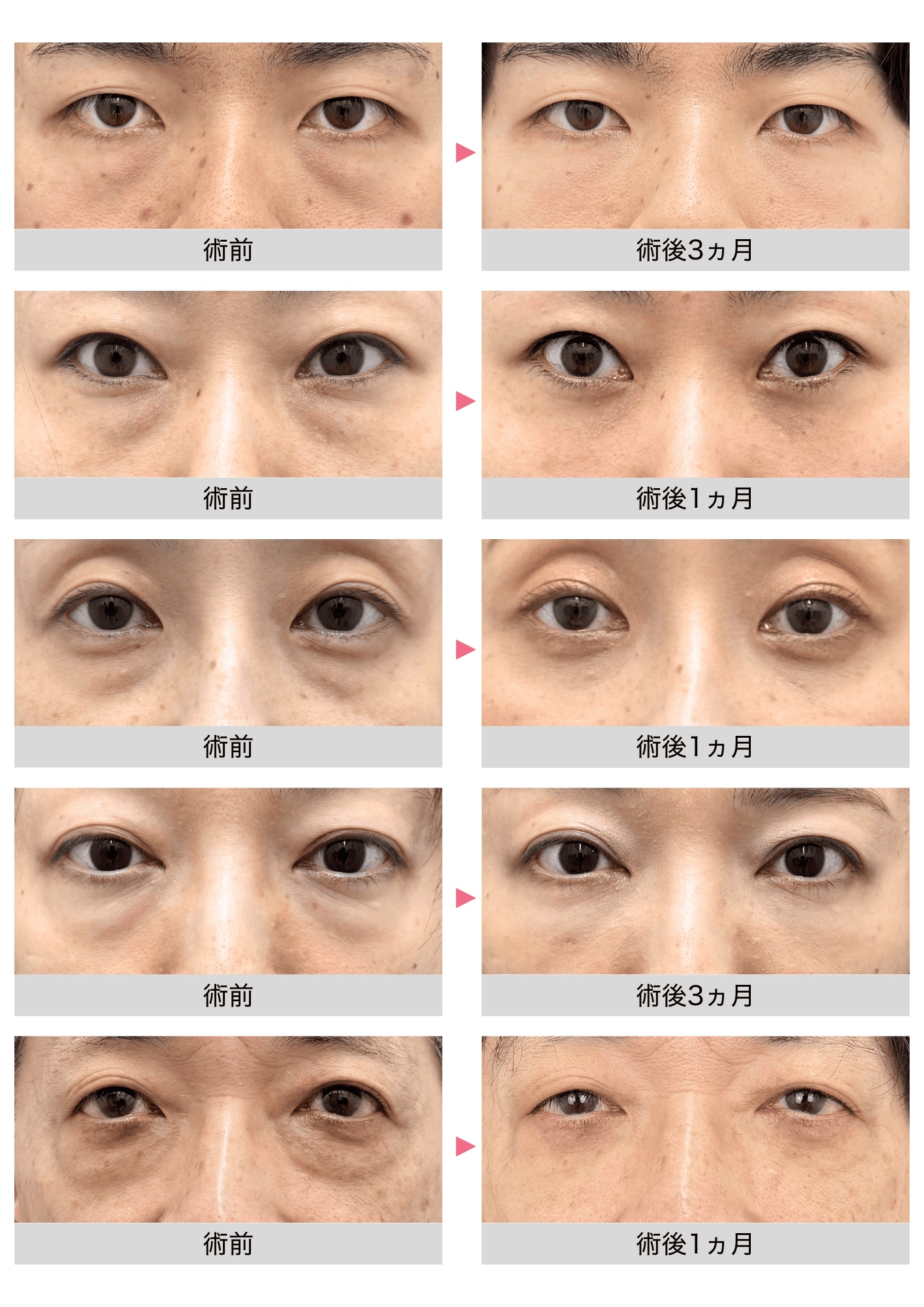 豊富な手術経験と確かな技術