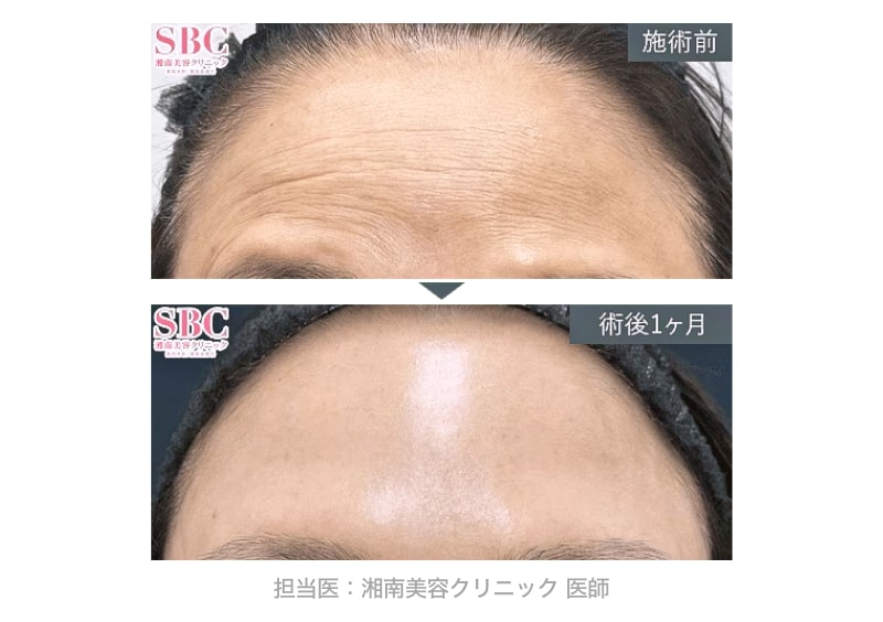 額