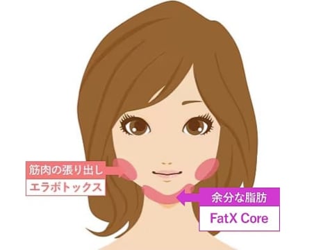 FatX Core × エラボトックスで小顔効果倍増