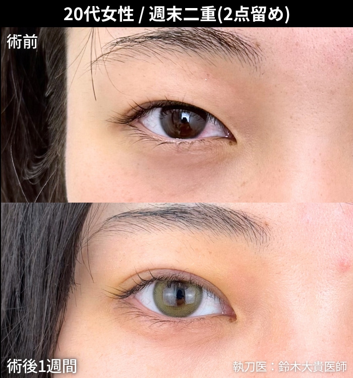 「美しすぎる二重」とSNSでも話題！ミリ単位のデザイン力