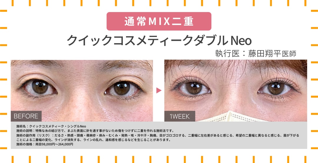 通常MIX二重