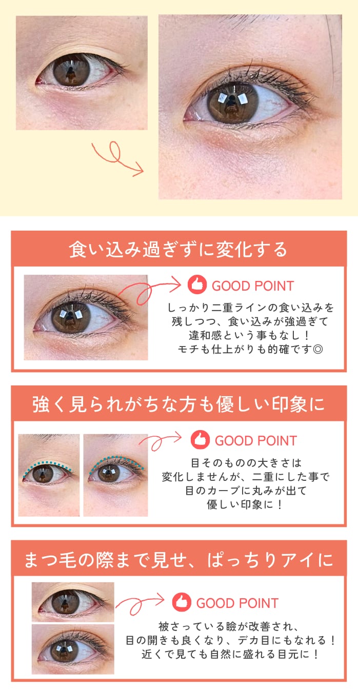目に丸みがでる事で