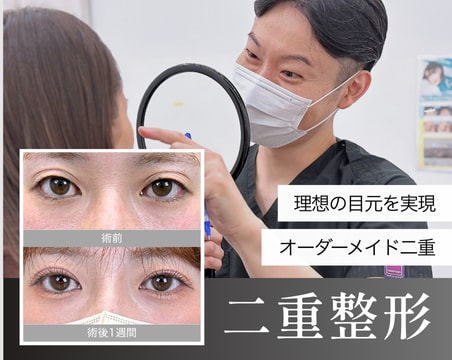 福島で二重整形するなら湘南美容クリニックいわき院で！〜目元で変わる二重形成〜