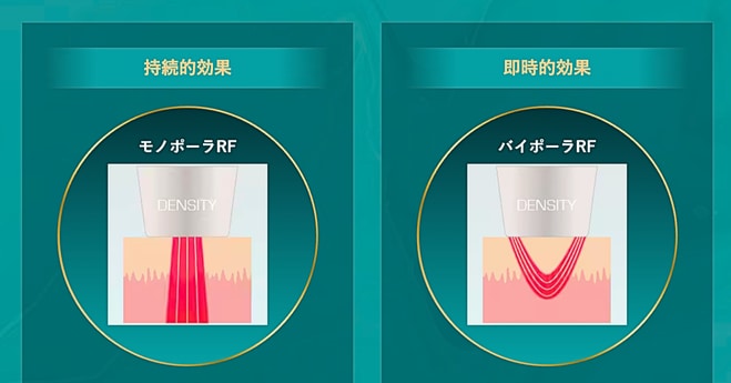 モノポーラ+バイポーラのモノバイ技術