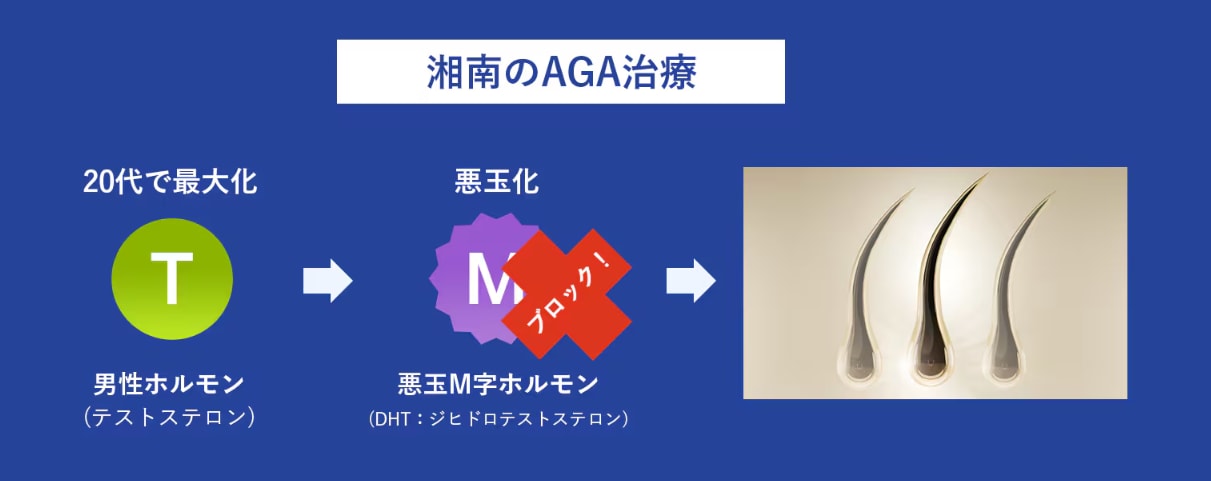 湘南のAGA治療薬なら体の内側から直接<br />
悪玉M字ホルモンをブロック！