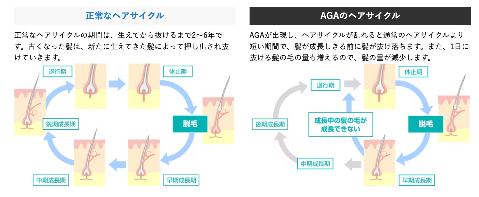 抜けて生えてを繰り返すと生えて来なくなる