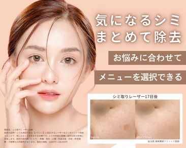 シミ取り1個 2,680円から😎☀️いわき市でシミ取りするなら湘南美容クリニックいわき院へ！
