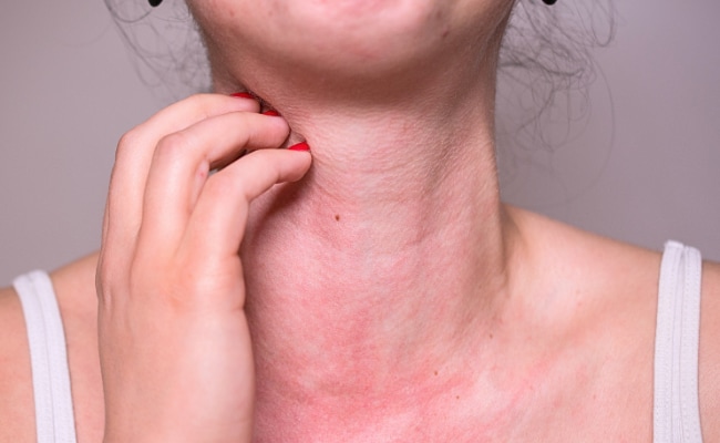 アレルギーを起こしにくい