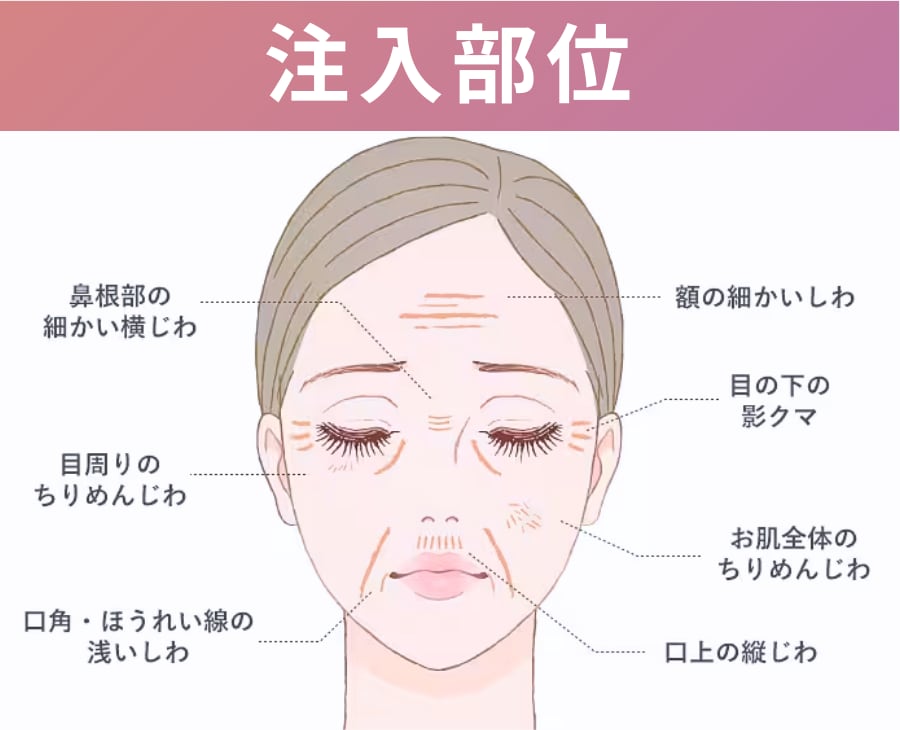 注入可能な部位を確認！