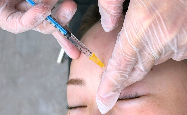 シワの予防はできても、できてしまったシワは治療が必要