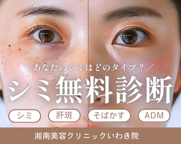 湘南美容クリニックいわき院のシミ取り治療