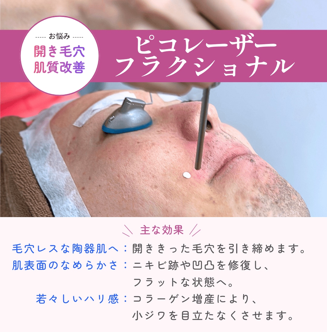 毛穴の開き・肌質改善にはピコレーザーフラクショナル