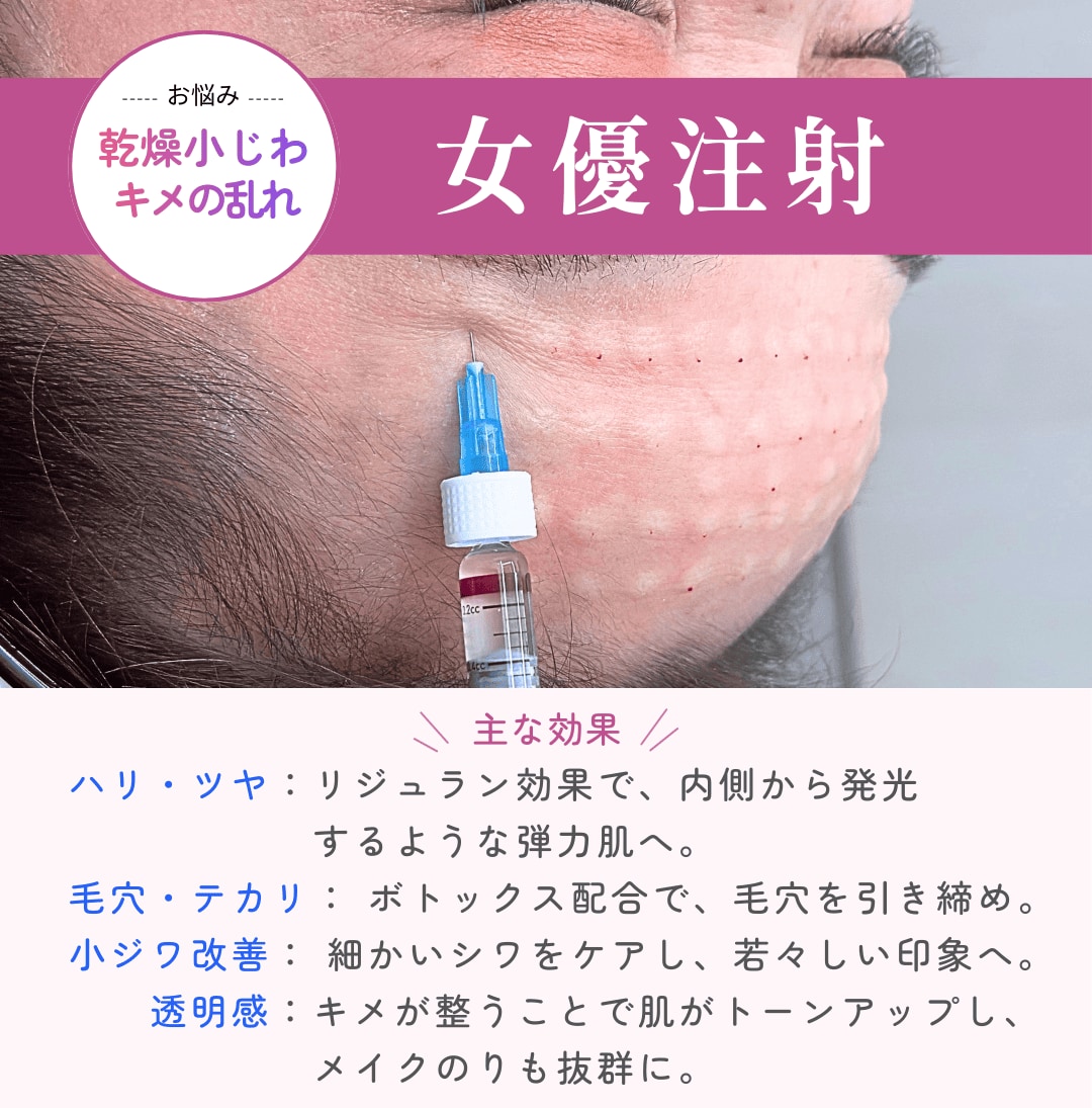 乾燥小じわ・キメの乱れには女優注射