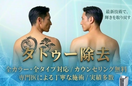 福島県いわき市で出来るタトゥー刺青除去【湘南美容クリニックいわき院】