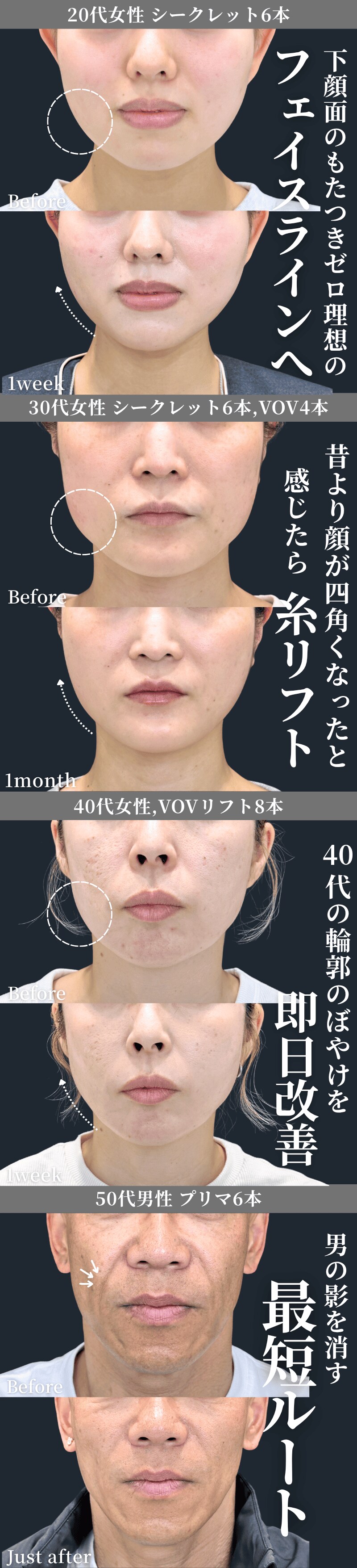 鈴木大貴院長がこだわるデザインと自然な仕上がり🪡