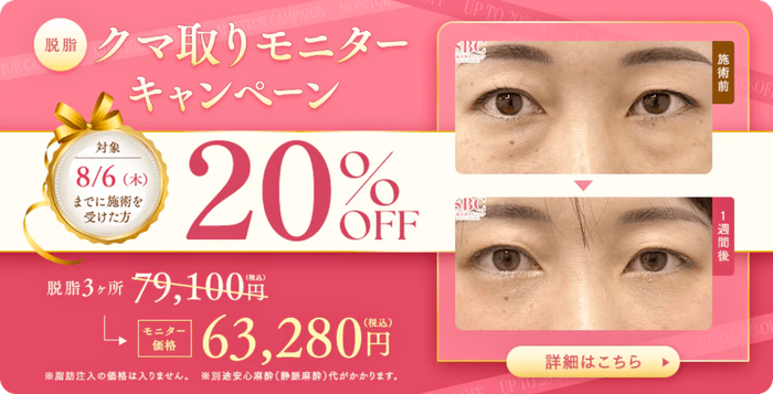 クマ取りキャンペーン【湘南美容クリニックいわき院】