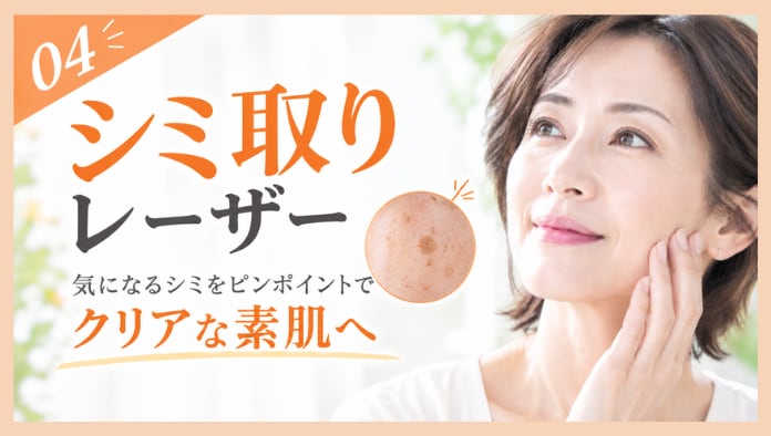 シミ取りレーザー