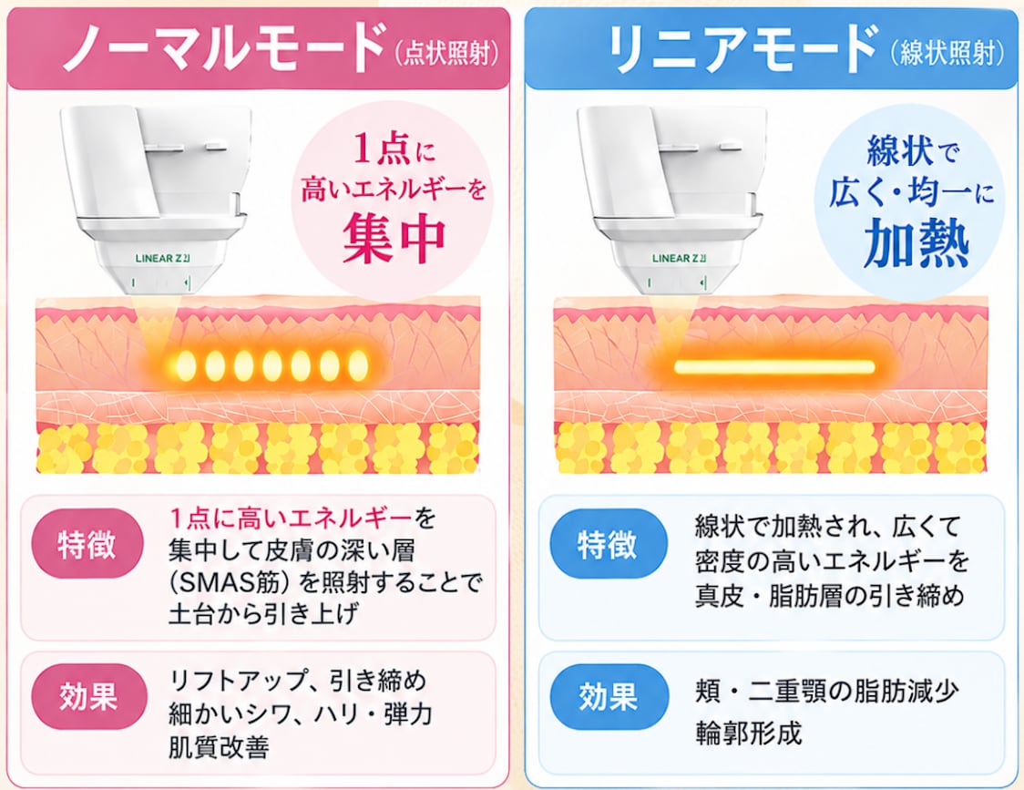 湘南美容クリニックの医療ハイフが待望のリニューアル！最新機器