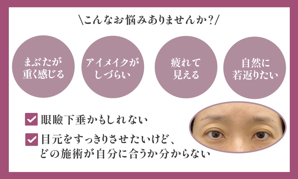 その悩み、もしかして“眼瞼下垂”かも？