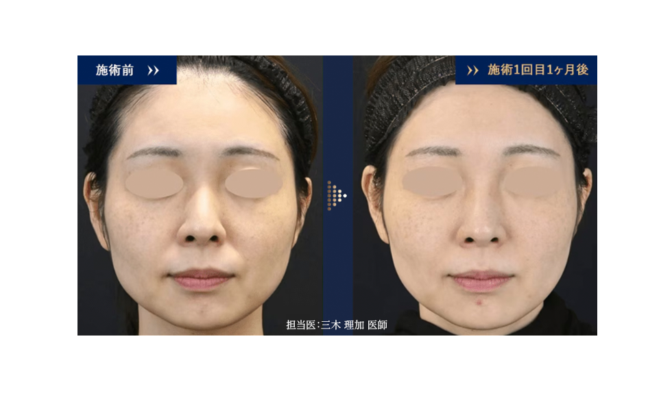 ジャルプロの効果